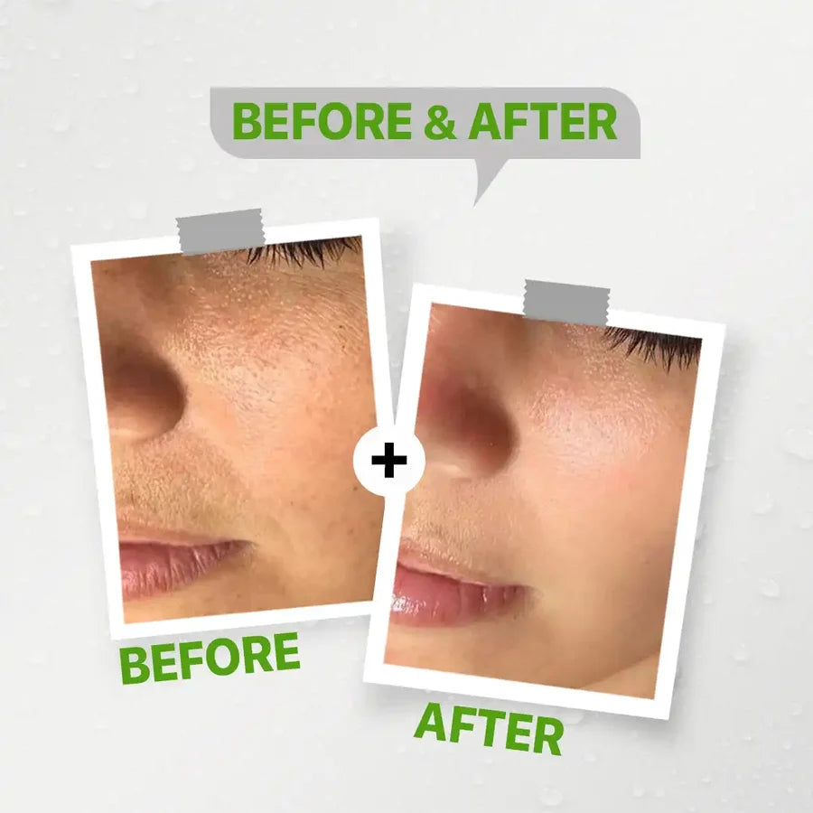 See-lit Exfoliator Facial Wash Cleanser 120ml